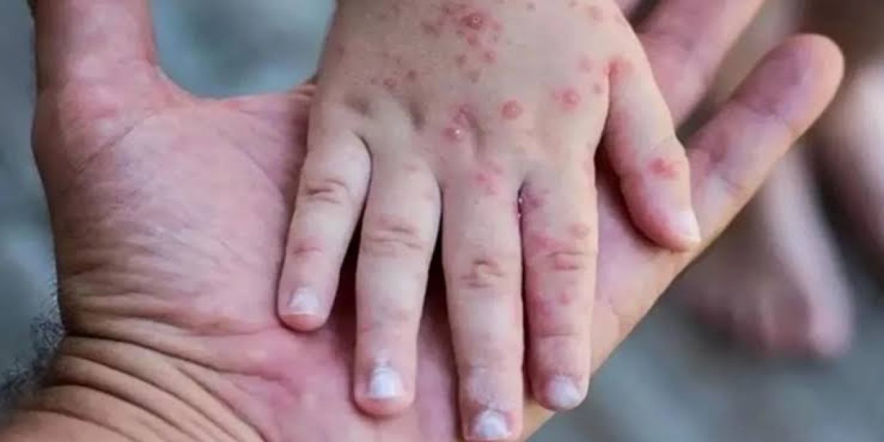 Okullara maymun çiçeği tatili gelir mi?