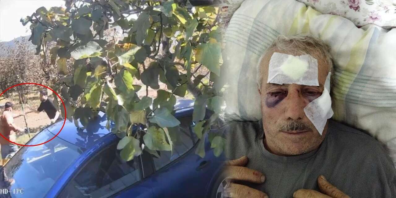 Lise Öğretmeni Yaşlı Komşusunu Muştayla Hastanelik Etti!